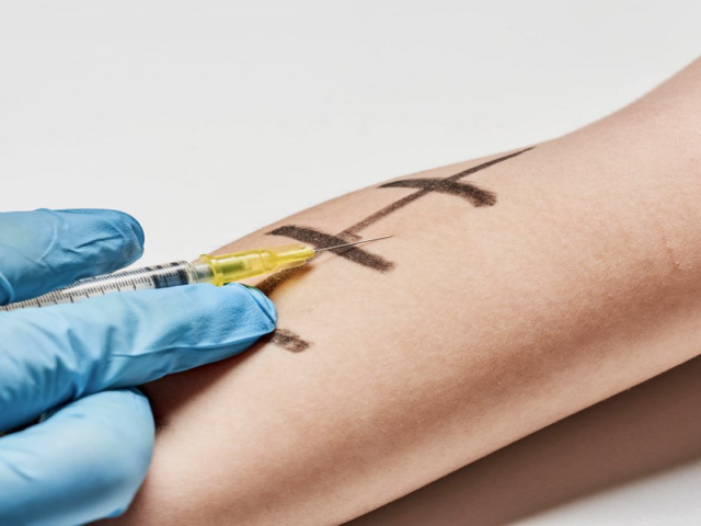 Allergy Testing Centres